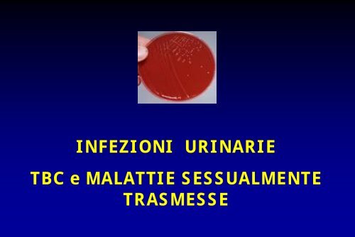 stenosi e prostatite cronica d stenosi e prostatite cronica d