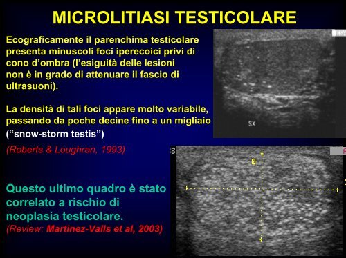 Inquadramento nosografico e indagini dell'azoospermia