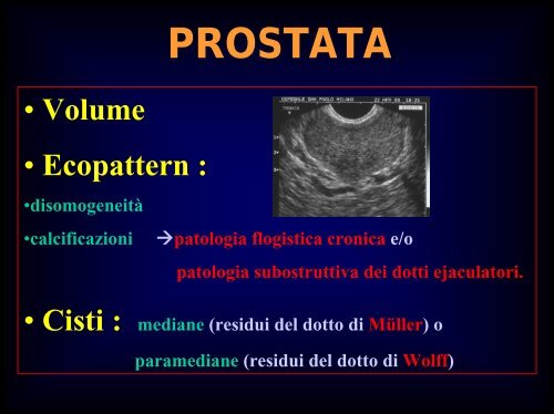 Inquadramento nosografico e indagini dell'azoospermia