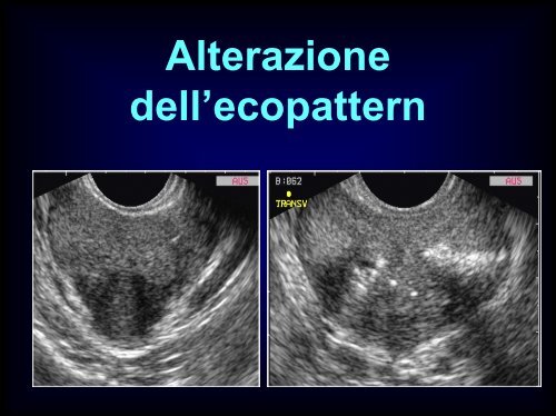 Inquadramento nosografico e indagini dell'azoospermia