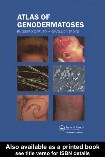 Atlas of Genodermatoses.pdf - E-Lib FK UWKS