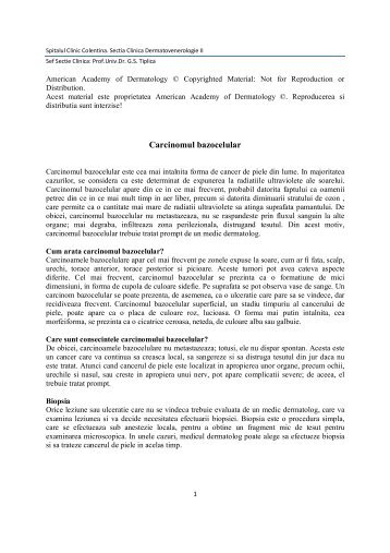 carcinomul bazocelular.pdf - Spitalul Clinic Colentina