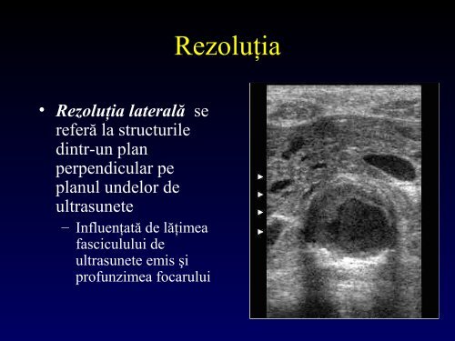 Introducere in ultrasonografia, R. Arafat