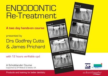 ENDODONTIC Re-Treatment - Godfrey Cutts