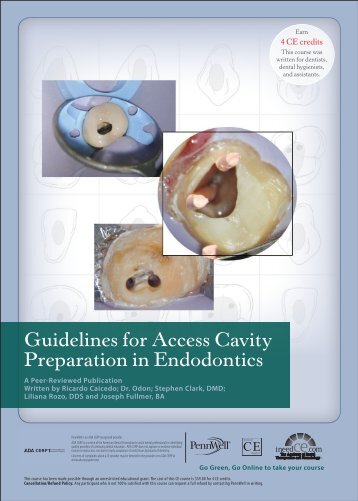 Guidelines for Access Cavity Preparation in Endodontics