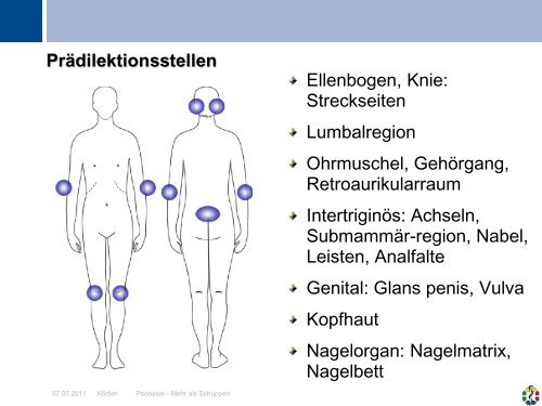 Psoriasis - Universitätsklinikum Essen