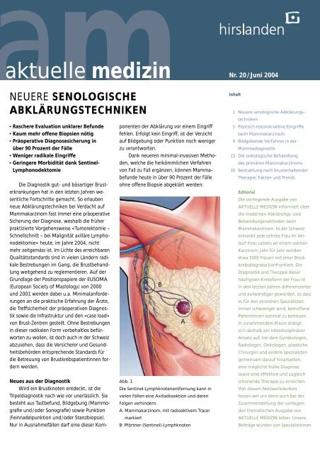 aktuelle medizin - Brust-Zentrum