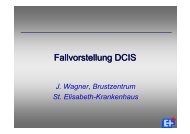 Fallvorstellung DCIS - St. Elisabeth-Krankenhaus GmbH