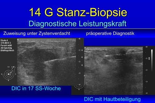 Interventionelle Diagnostik unter Ultraschall- kontrolle