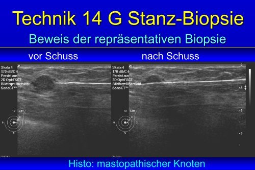 Interventionelle Diagnostik unter Ultraschall- kontrolle