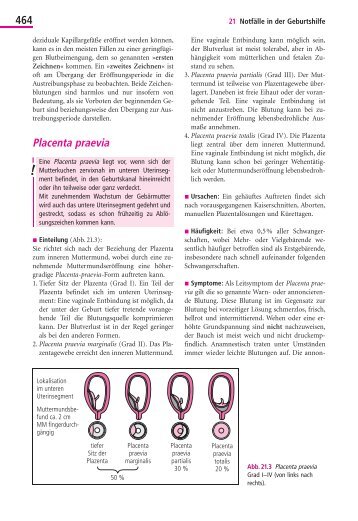 Placenta praevia 464 - Schattauer