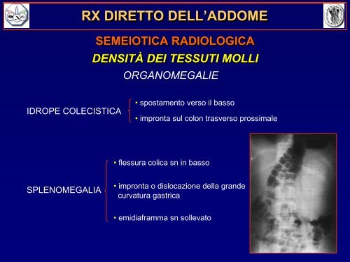 rx diretto dell'addome - Ferrariradiologia.it