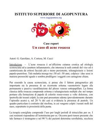 Posizione di gambe a trombosi
