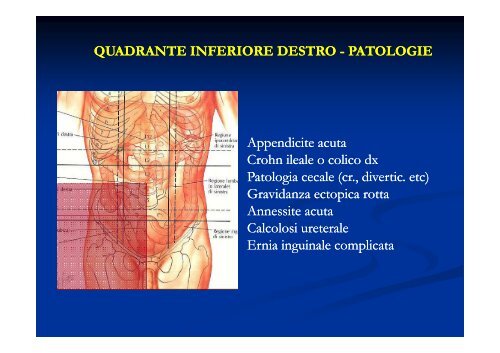 Semeiotica clinica in urgenza nel dolore addominale acuto: ? serve ...