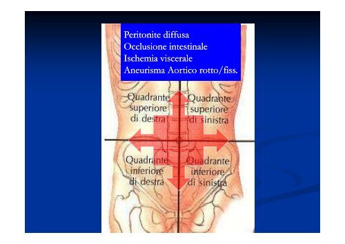 Semeiotica clinica in urgenza nel dolore addominale acuto: ? serve ...