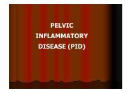 PELVIC INFLAMMATORY DISEASE (PID) - Ginecologia