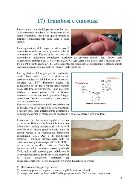 Trombosi ed emostasi - Dieta della salute
