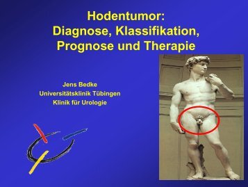 Hodentumor - Universitätsklinik für Urologie in Tübingen