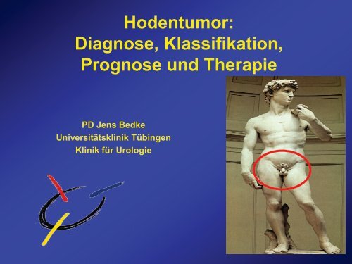 Hodentumor: Diagnose, Klassifikation, Prognose und Therapie