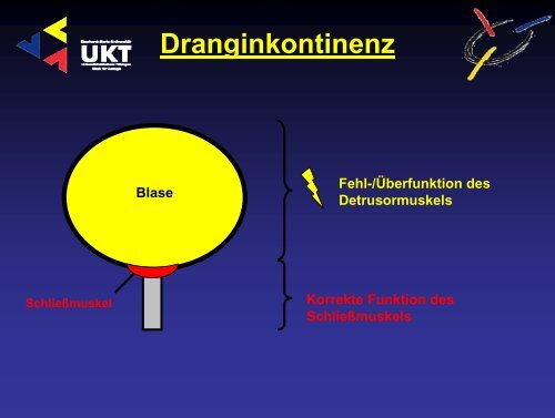 Harninkontinenz - Universitätsklinik für Urologie in Tübingen