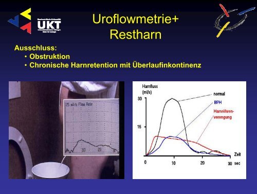 Harninkontinenz - Universitätsklinik für Urologie in Tübingen