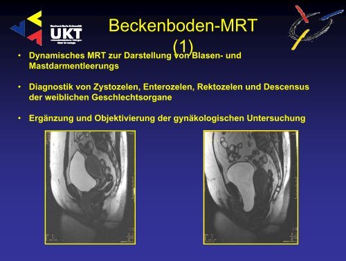 Harninkontinenz - Universitätsklinik für Urologie in Tübingen