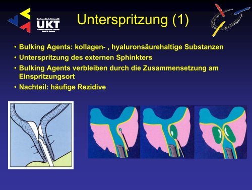 Harninkontinenz - Universitätsklinik für Urologie in Tübingen