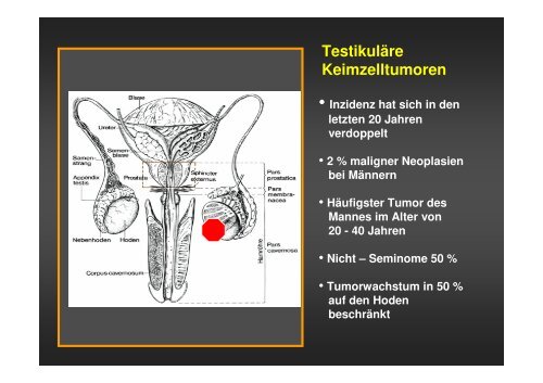 Therapie von Hodentumoren - Universitätsklinik für Urologie in ...