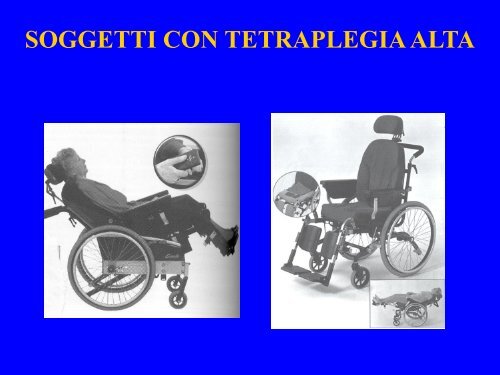 LEZ III ANNO patologie e carrozzine.pdf - FISIOTERAPIA-Pavia