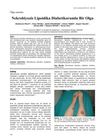 Nekrobiyozis Lipoidika Diabetikorumlu Bir Olgu - Yeni Tıp Dergisi