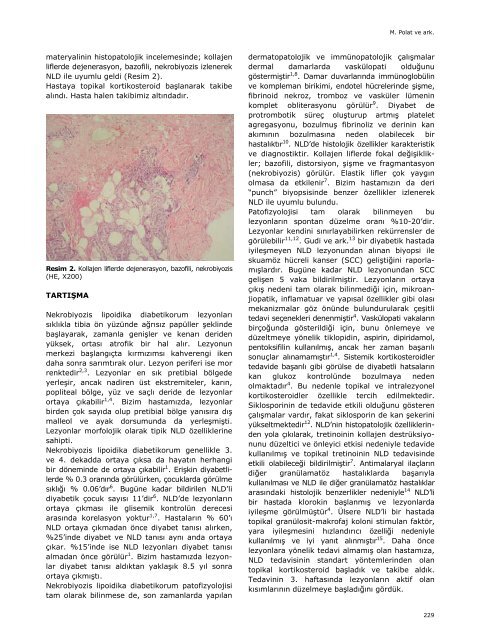 Nekrobiyozis Lipoidika Diabetikorumlu Bir Olgu - Yeni Tıp Dergisi