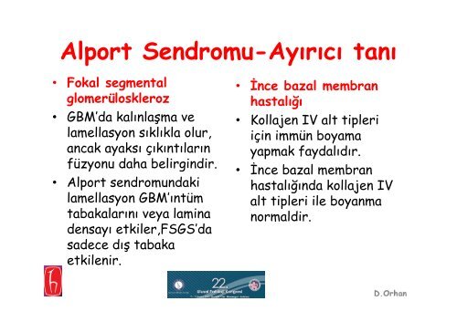 Alport Sendromu