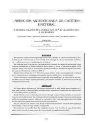 INSERCIÓN ANTERÓGRADA DE CATÉTER URETERAL