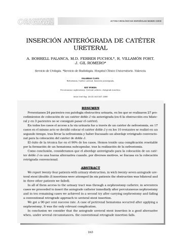 INSERCIÓN ANTERÓGRADA DE CATÉTER URETERAL