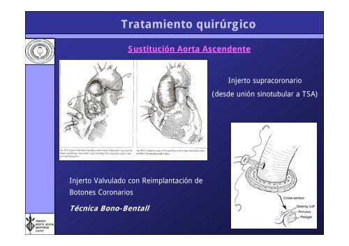 Presentación - Hospital General Universitario de Valencia.