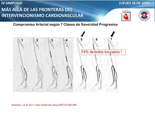 Anterógrado o retrógrado? - CACI