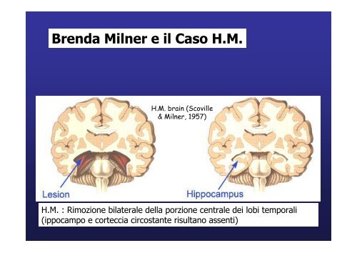 Lobo temporale memoria Lobo temporale memoria - Neurofisiologia ...