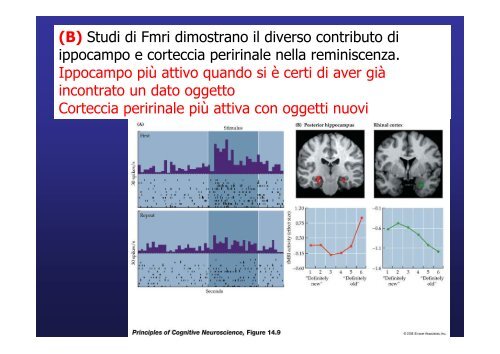 Lobo temporale memoria Lobo temporale memoria - Neurofisiologia ...