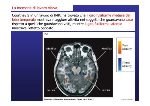 Lobo temporale memoria Lobo temporale memoria - Neurofisiologia ...