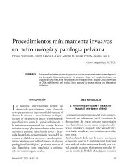 Procedimientos m&iacutenimamente invasivos en ...