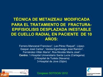 TÉCNICA DE METAIZEAU MODIFICADA PARA EL ... - Sotocav