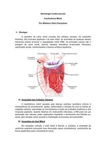 Semiologia Cardiovascular Insuficiência Mitral Por Matheus ... - UFF