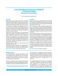 CLAVO ENDOMEDULAR DE TIBIA EN EL TRATAMIENTO DE ...