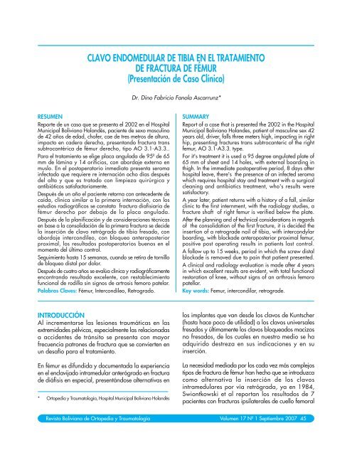 CLAVO ENDOMEDULAR DE TIBIA EN EL TRATAMIENTO DE ...