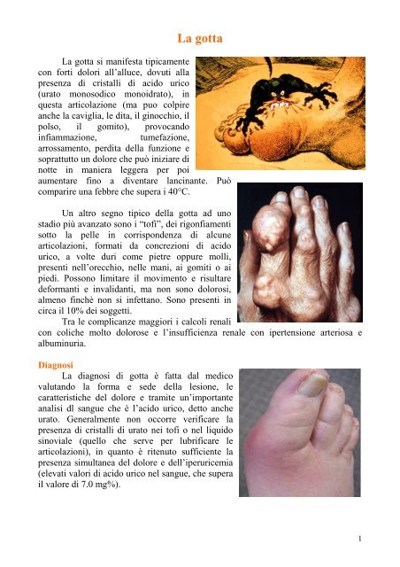 dieta per acido urico alto e colesterolo dieta per acido urico alto e colesterolo