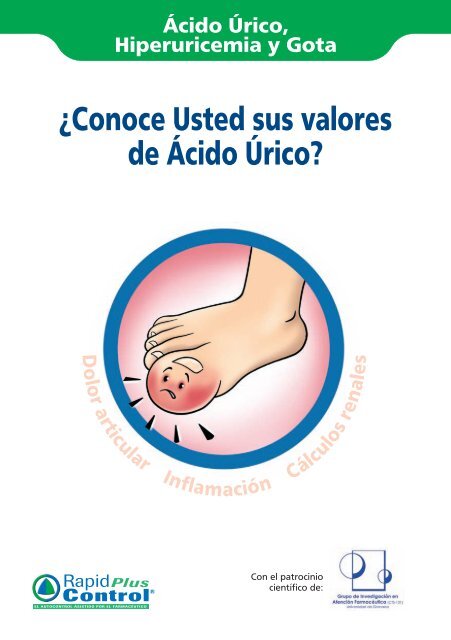 nefropatía aguda por ácido úrico síntomas de diabetes