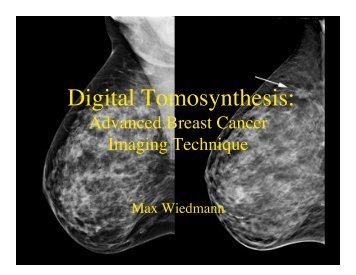 Digital Tomosynthesis: