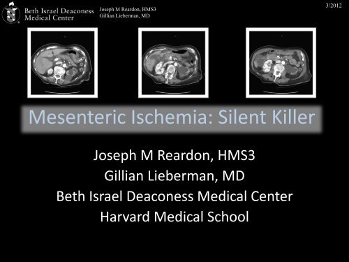 Mesenteric Ischemia: Silent Killer - Lieberman's eRadiology ...