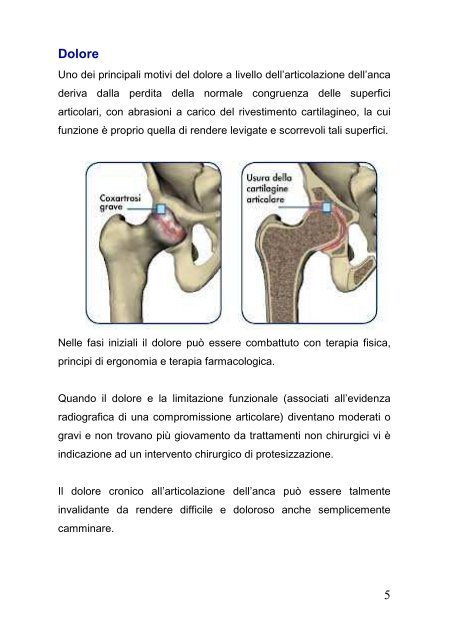 artroprotesi anca - Ospedali riuniti di Trieste