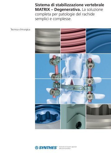 Sistema di stabilizzazione vertebrale MATRIX ... - Synthes